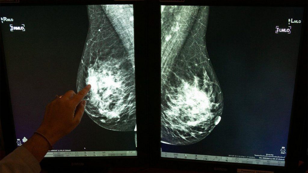 What Our Patients With Dense Breasts Deserve to Know