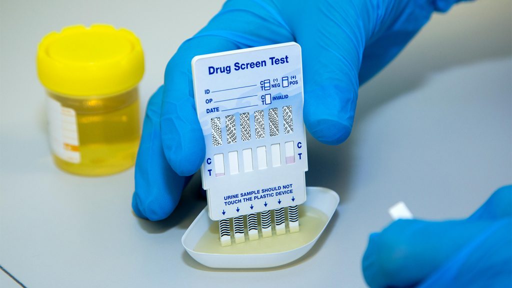 Think Twice Before Drug Testing Your Black Patients