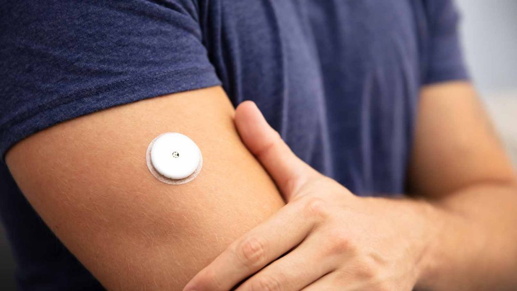 Here’s What OTC Continuous Glucose Monitors Can Do for Our Patients
