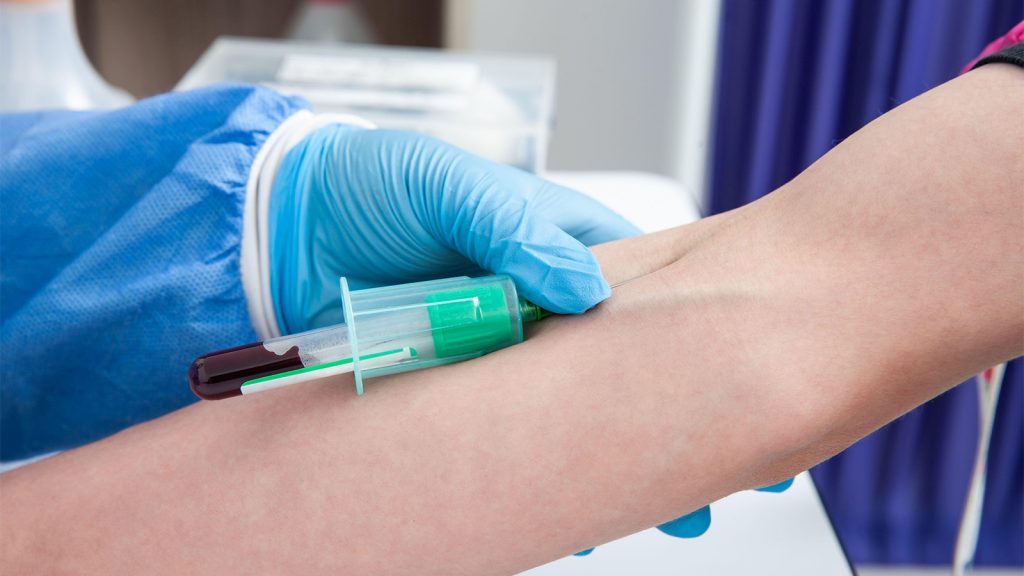 Blood Test for Colon Cancer: Panacea or Hype?