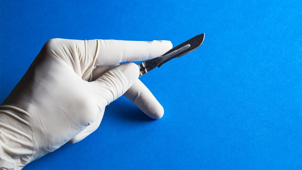 Female Genital Mutilation Happens in America, Too