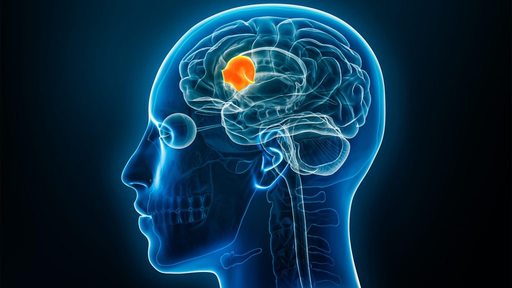 A Case of Broca’s Aphasia