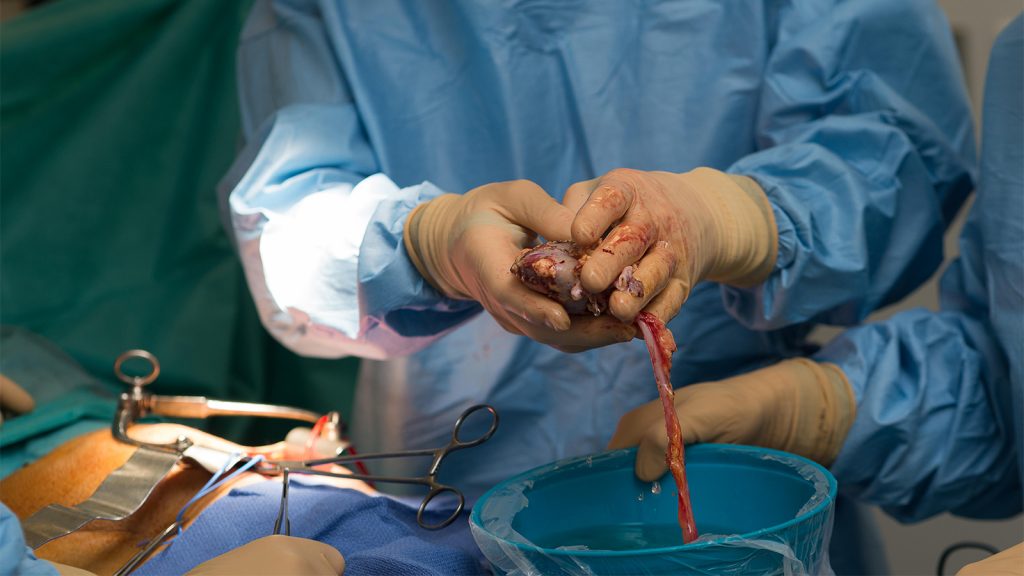 Bodies Into Other Bodies