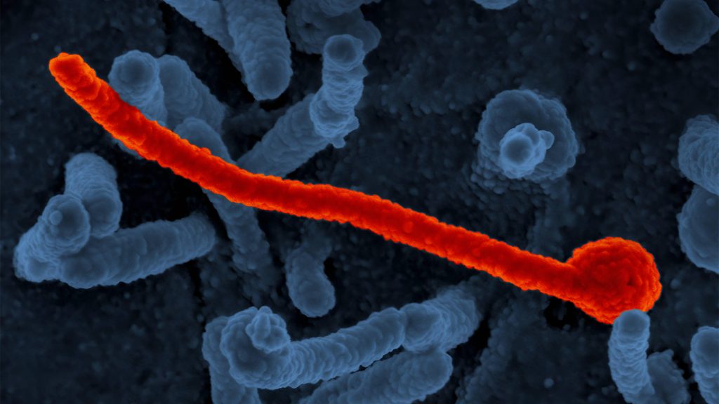 What Would You Do If an Ebola Patient Checked Into Your Hospital?