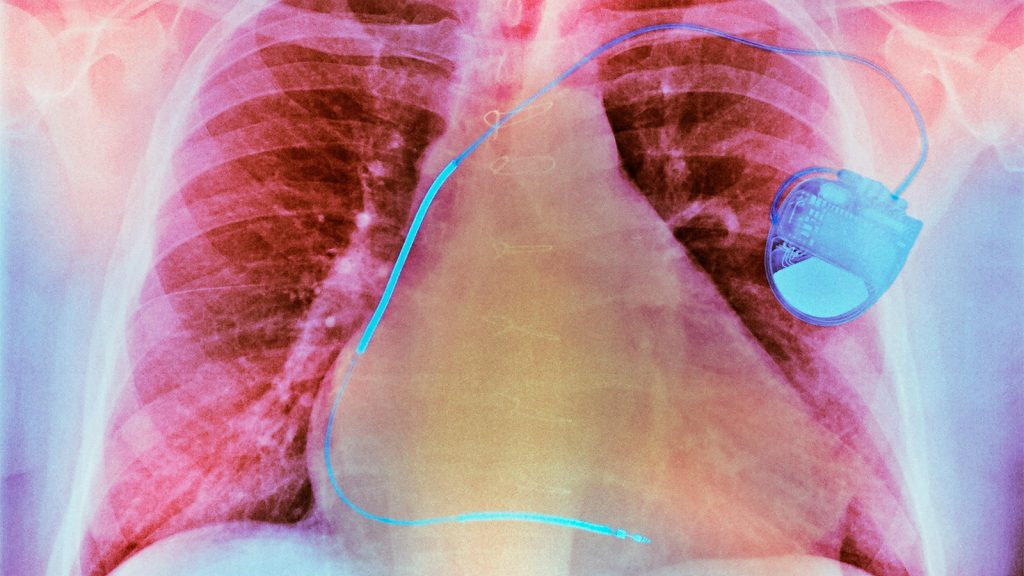 The Medical Dilemma at the Heart of Byron Black’s Execution