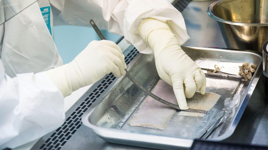 Skin Substitute Abuse Wounds Both Taxpayers and Seniors