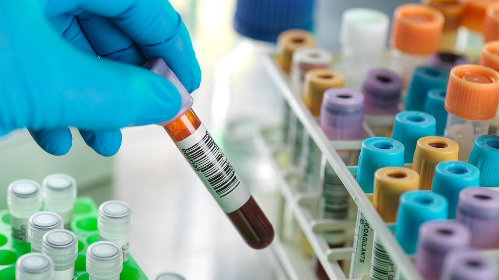 Spotting Trends in Patients’ Tests